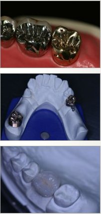 High Quality Dental Restorations