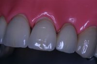 Dental Ceramist Devon